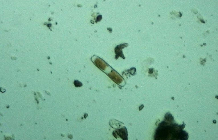 Hantzschia