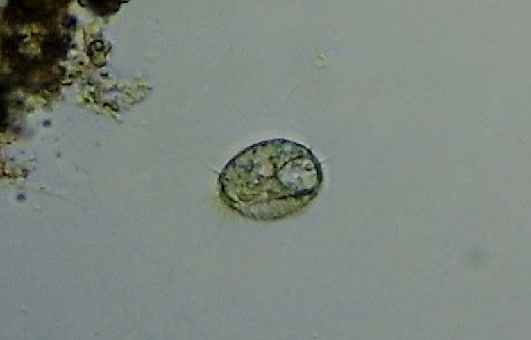 ciliate protozoa