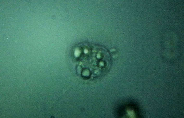 Heliozoa