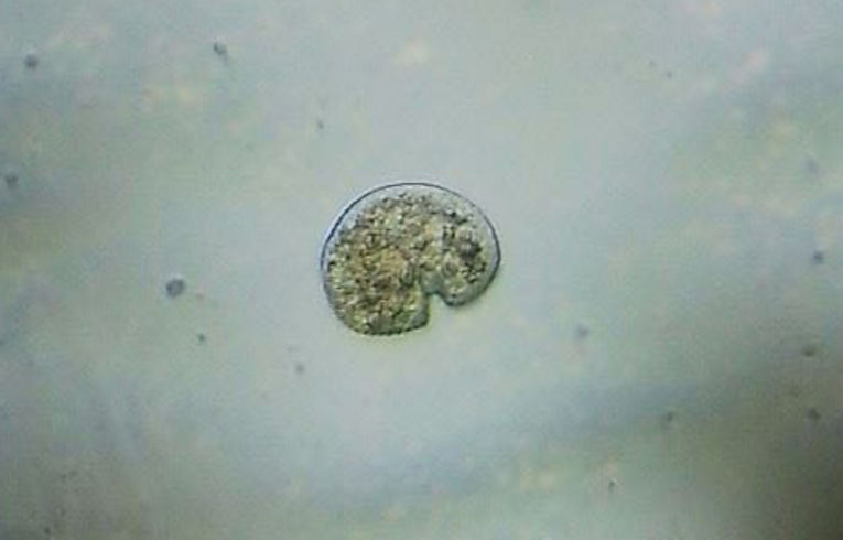 ciliate protozoa
