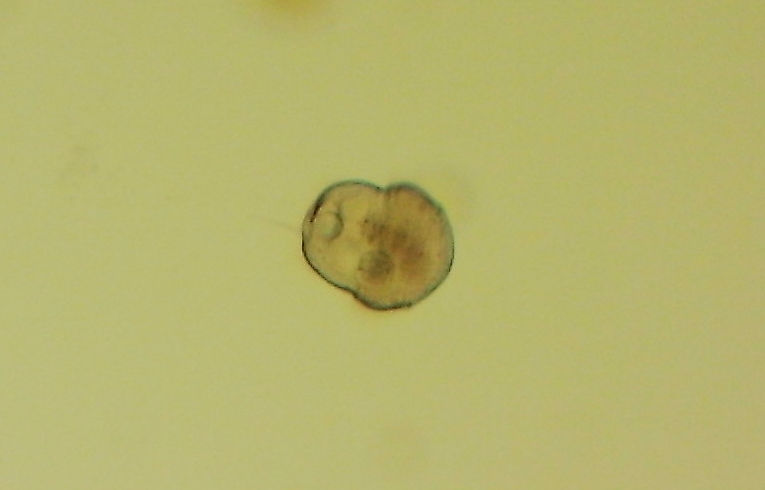 ciliate protozoa - Urocentrum