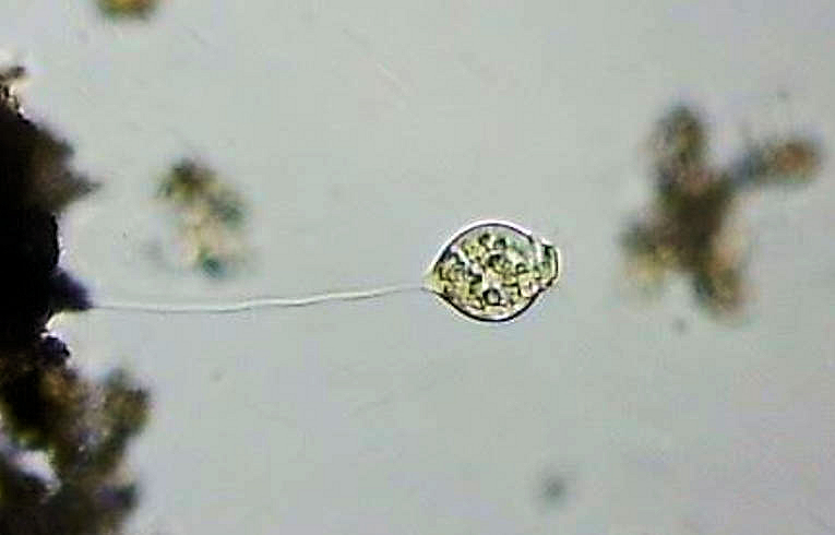 protozoa - Vorticella
